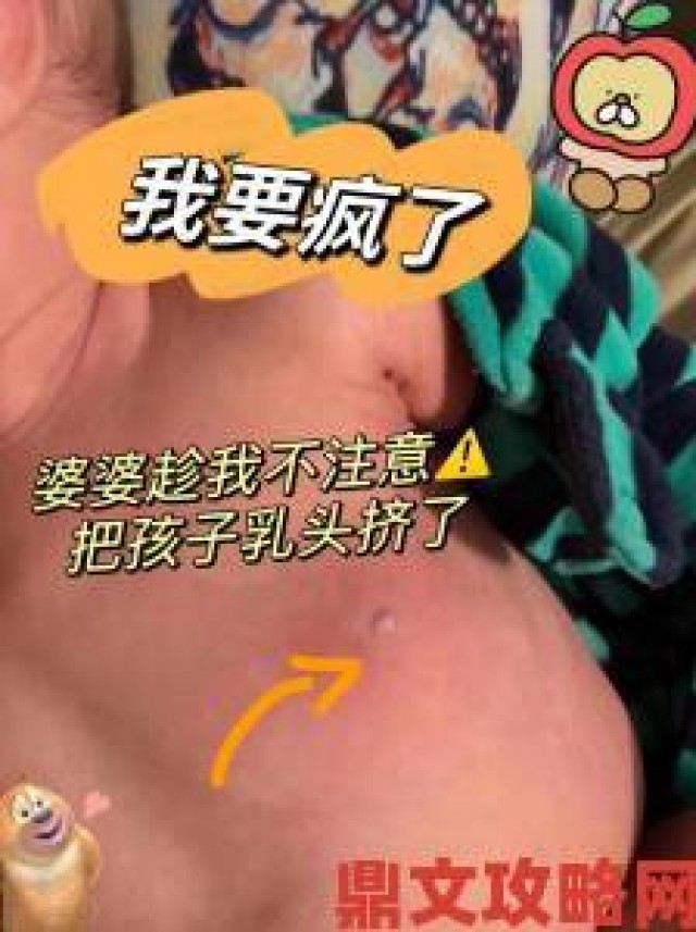 动态|稚嫩的小奶头被咬得又红又肿引关注 医生呼吁重视哺乳姿势矫正