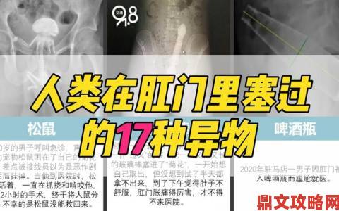 肛门塞带了一晚上取出来很疼患者维权实录曝光医院治疗流程漏洞