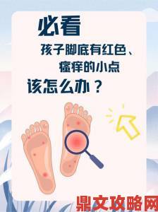 固定手脚的痒女生脚心案例曝光专家提出三点科学止痒对策