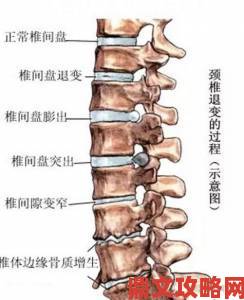 深入浅出老干部的颈椎病背后触目惊心的举报黑幕曝光